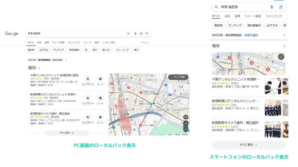 基本のローカルパックの画像